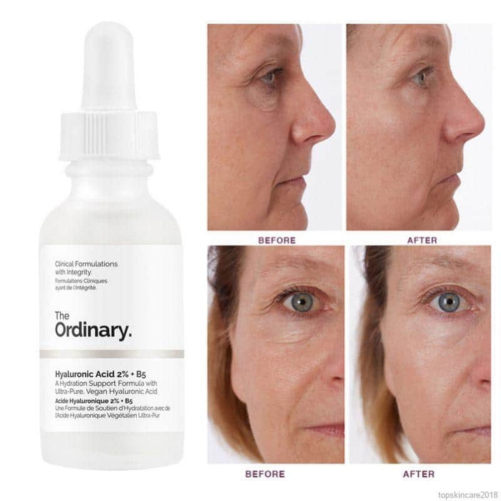 The Ordinary Hyaluronic Acid 2% + B5 30 Ml