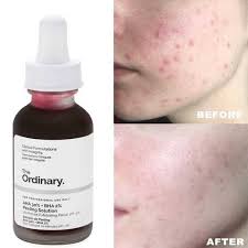 The Ordinary Aha 30% + Bha 2% Peeling Solution 30 Ml
