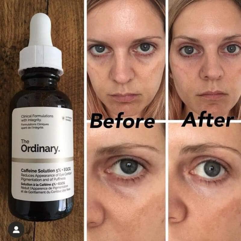 The Ordinary Caffeine Solution 5% + EGCH 30 mL